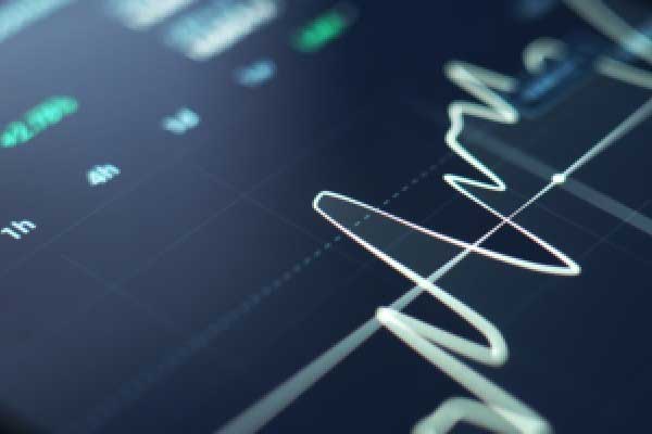 里昂：降比亚迪电子目标价至48港元 维持“跑赢大市”评级